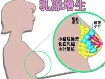 乳腺增生吃鹿角帽粉